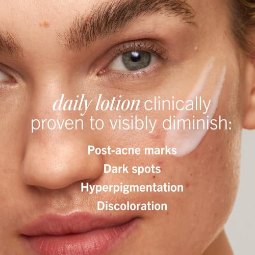 First Aid Beauty Daily Resurfacing Lotion with 2% Niacinamide - 1 oz - Fades Acne Marks, Hydrates & Brightens Skin