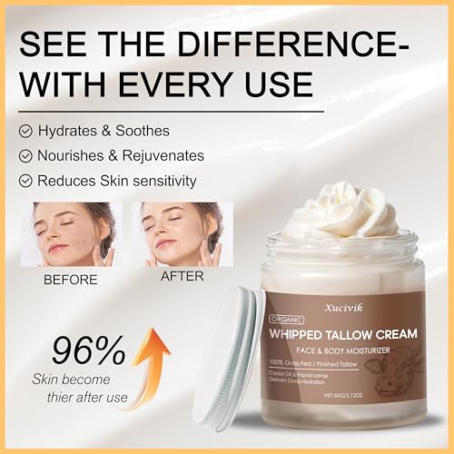 Grass-Fed Beef Tallow Face Moisturizer with Frankincense Oil & Castor Oil,Ultra-Hydrating Non-Greasy Formula,Organic Tallow Balm for Skin Hydration, Anti-Aging, and Sensitive Skin Care ,2.72oz