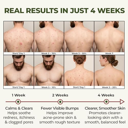 ABERA High-Performance Folliculitis Body Wash with Wild Bitter Melon & BHA - 2 Boxes + BHA Acne Spray Gift