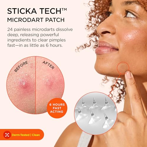 ZitSticka KILLA Microdart Pimple Patch Kit - 20 Count, Fast-Acting Acne Treatment