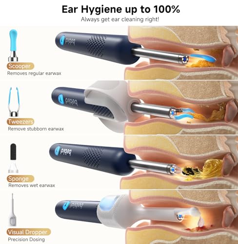 BEBIRD R1 Ultra Ear Wax Removal Kit with 1296P HD Ear Camera – Blue