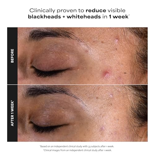 Paula's Choice 2% BHA Liquid Exfoliant for Face - 4 Fl Oz Pack of 2