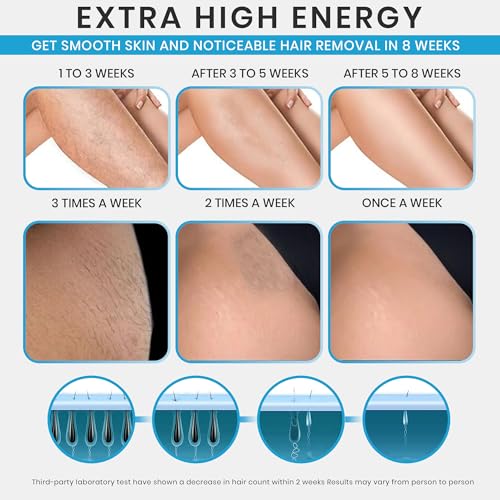 IPL Laser Hair Removal Device for Face & Body - Permanent Hair Removal for Women & Men