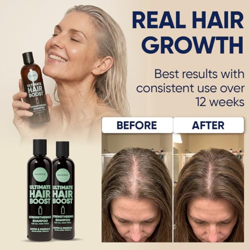 Moerie Hair Growth Shampoo for Men & Women - Single, Thickening & Natural Hair Loss Solution