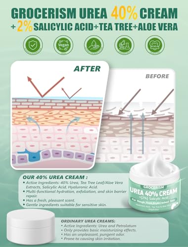 Grocerism Urea Foot Cream 40% with Salicylic Acid - 5.29 oz Pack of 2 for Dry & Callused Feet