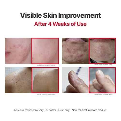 PRO-RESOLVING SERUM PLUS