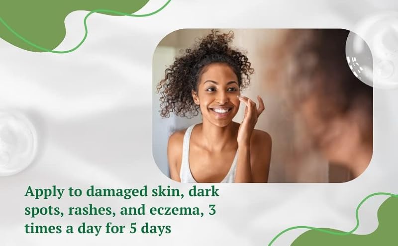 Aloe Vera Dark Spot Corrector & Skin Hydrating Cream for Face & Body