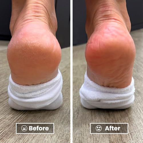 LONDONTOWN Foot Balm 4 Fl Oz - Hydrating Cracked Heel Repair Moisturizer
