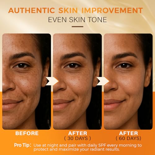 QOOQ Turmeric Kojic Acid Soap for Dark Spots Remover ? Facial Cleansing Bar with Vitamin C, Retinol, Collagen, Vitamin E, Glycerin, Shea Butter & Castile Olive Oil ? Soap for Women & Men (120g x 2)