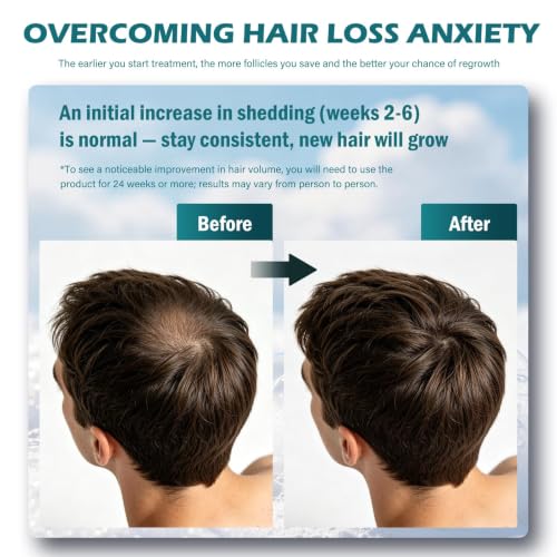 5% Minoxidil Foam for Men Hair & Beard Growth - Extra Strength, Unscented, 4.22oz (2 Pack)