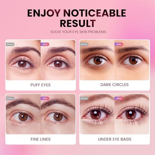 Tri-Color Glitter Under Eye Patches (48 Pairs) for Dark Circles & Puffiness - Nourishing Collagen & Hyaluronic Acid