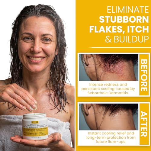 Medicated Psoriasis & Eczema Shampoo + Scrub for Itchy Scalp – Repairs & Strengthens Hair