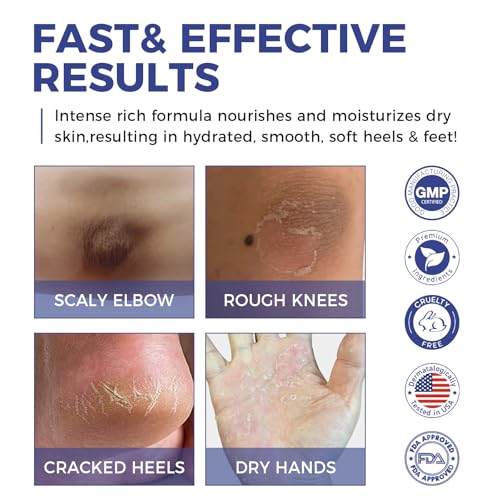 Urea Cream 42% with Salicylic Acid for Dry Rough Skin - 2 Bottles, 5.29 oz Each