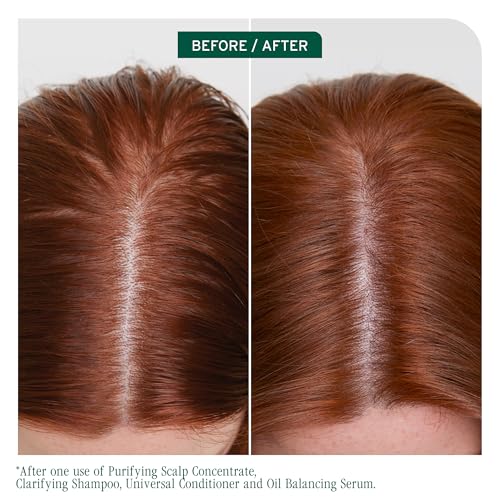 Biolage Scalp Sync Clarifying Shampoo 33.8 Fl Oz Pack of 2 - Residue & Buildup Remover for Oily Scalp