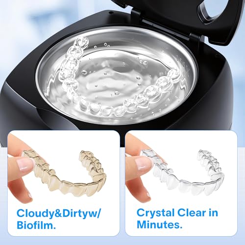 Ovatt Ultrasonic Retainer Cleaner 45kHz with UV Light, 340ML Large Capacity Dental Pod for Aligners and Dentures