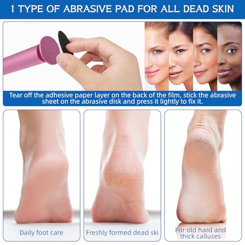 Electric Foot File - Callus Remover, Adjustable Speed, 60pcs Replacement Sandpaper Disks, Aluminum, Pink