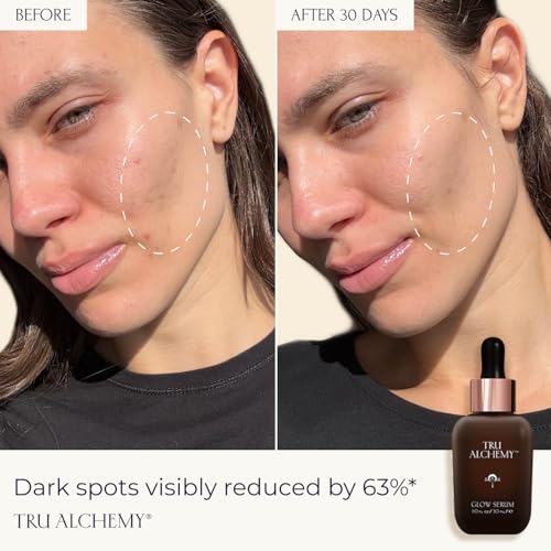 Tru Alchemy Vitamin C Glow Serum - Hydrating Anti-Aging Vitamin C Face Serum with Bakuchiol, Glycolic & Lactic Acid, 1 fl oz.