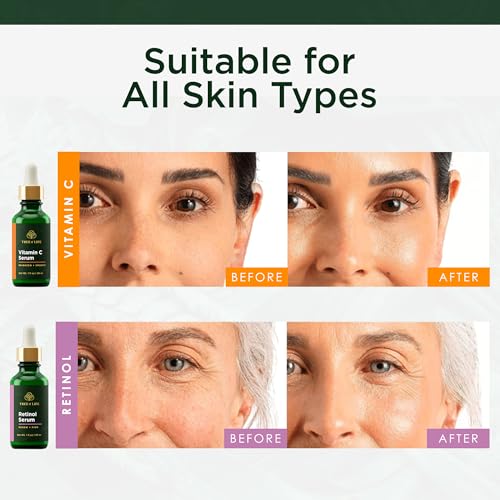 Tree of Life Brighten & Renew Face Serum Set with Vitamin C & Retinol