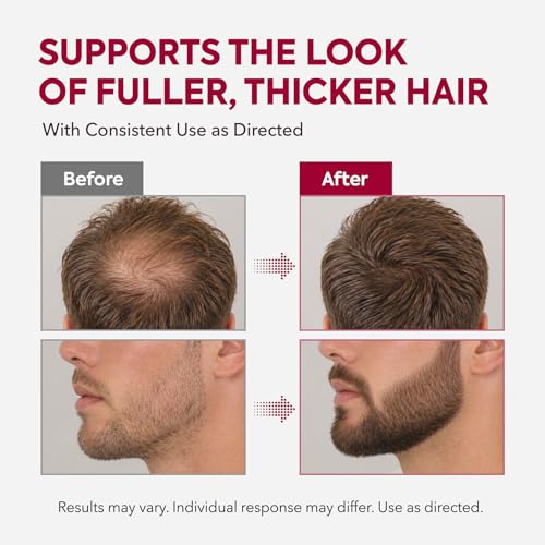 2 Pack Minoxidil Hair Growth Kit for Men and Women - Beard & Scalp Serum with Biotin - 4 Fl Oz