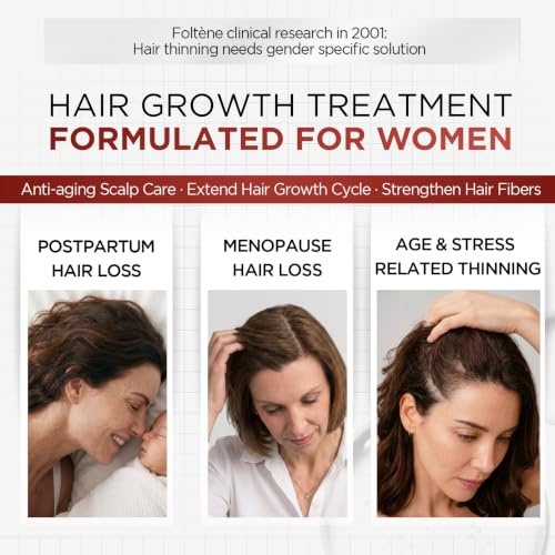 Foltene Hair Growth Serum for Women 35+ – Clinically Proven Thinning Hair Treatment, 12 Vials