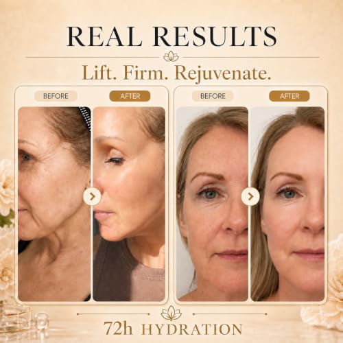 Anti-Aging Firming Cream Set for Face, Neck & Décolleté with PDRN & Collagen