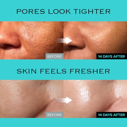 Ice Sorbet Soothing & Cooling Face Moisturizer | Non-Comedogenic Gel Cream for Fungal Acne | Pore Minimizer for Face Under | Makeup Primer | Niacinamide & Silica for Sebum Control | 3.38 Fl Oz