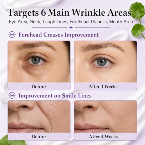 Retinol Serum for Face - Tightening Booster with Green & Purple Variation, 0.15% Retinol, 30ml