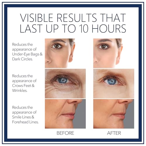 Rapid Reduction Eye Serum - Visibly Reduces Under-Eye Bags, Wrinkles, Dark Circles, Fine Lines & Crow's Feet Instantly, Facial Serum-10ML