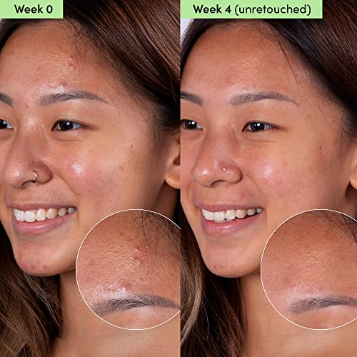 Sand & Sky Oil Control Clay Face Mask with Salicylic Acid & Niacinamide for Blemish-Prone Skin