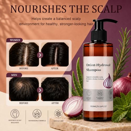 Miracle TQ Onion Hair Growth Shampoo with Biotin & Rosemary - Thinning & Loss Control, 10.14oz
