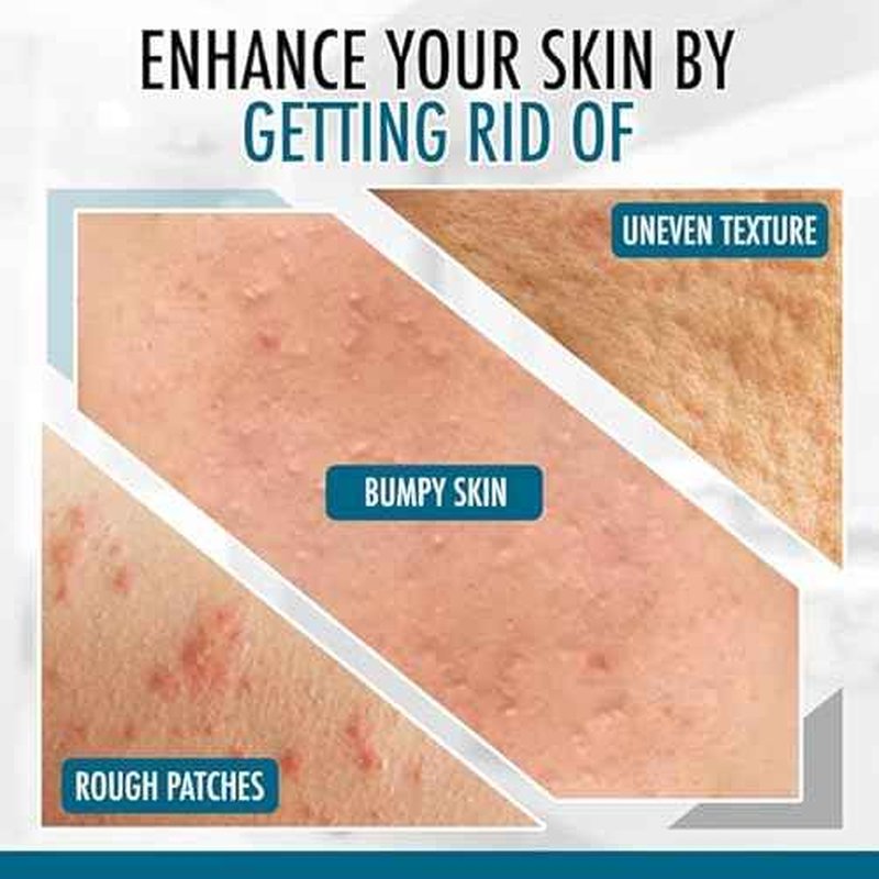 GLY MIRACLE Moisturizing Body Cream Lotion, 16 ounce - Non-Greasy Skin Humectant for Extremely Dry Skin, Hands, Body, and Feet, Light Fresh Scent with Pure Glycerin for Nourishing Hydration.