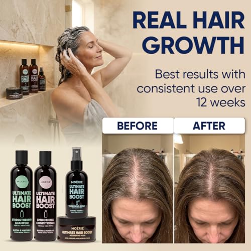 Moerie Hair Growth Set with Biotin & Rosemary – Shampoo, Conditioner, Mask & Spray – 4 Items (Single Set)