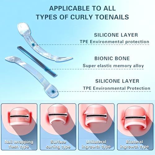 Titanium Alloy Ingrown Toenail Treatment - Professional Home Care for Curved Nails - Waterproof, Nail Tools and Ingrown Toenail Removal Kit,Ingrown Toenail Corrector(0.59/0.67in)