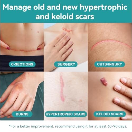 Dimora Hydrocolloid Wound Dressing & Silicone Scar Sheets