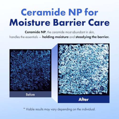 ATOSOOP 365 Barrier Cream with 5% Panthenol & Ceramide for Sensitive Dry Skin