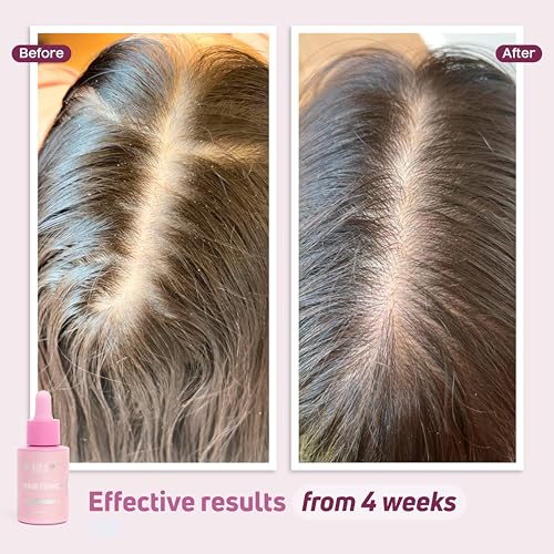 Hair Tonic for Thicker Fuller Hair & Oily Scalp Control - 1 Oz