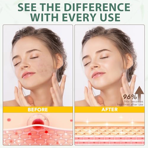 WHLH & WELL-BEING Beef Tallow for Skin, Beef Tallow and Honey Balm, All-Natural Ingredient Moisturizer for Face & Body Skin Care 1Pack