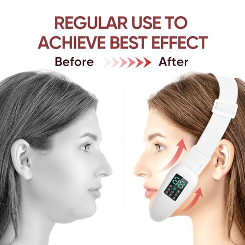 Intelligent Electric Double Chin and V-Shaped Face Machine with 8 Modes & 15 Adjustable Intensities - Women's V-Face Device - White