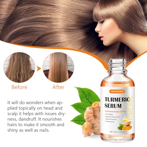 Turmeric Serum for Dark Spots£¬2 PCS Face Serum Turmeric Dark Spot Corrector Serum for Face, Moisturizing Massage Essence Reduces Hyper pigmentation Age&Sun Spot, Facial Serum for Women & Men 1Fl Oz