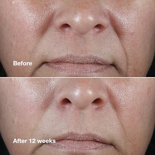 Clinique Smart Clinical Repair Wrinkle Correcting Face Cream with Peptides & Hyaluronic Acid - Hydrating Anti-Aging Moisturizer for Dry Skin, 1.7 Fl Oz