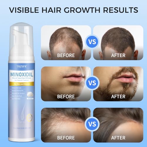 Minoxidil Foam for Hair & Beard Growth - 2.8 Fl Oz Pack of 5 - 6 Month Supply