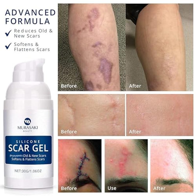 100% Silicone Scar Gel 3-Pack ? 3 x 1.06oz Scar Cream for Long-Term Scar Care ? C-Section, Surgery, Acne, Keloids, Burns ? Fades Old & New Scars Fast