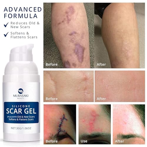 3 Pack Silicone Scar Gel - Fast-Acting Scar Fader for Surgery, Acne & Burns - MURASAKI BEAUTY