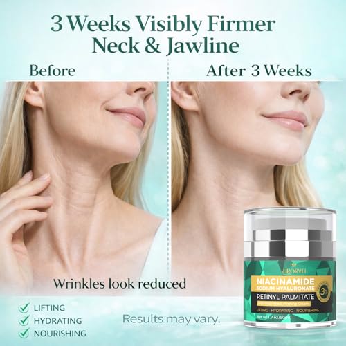 Face Neck Firming Cream Retinol Collagen Hyaluronic Acid Anti Aging Wrinkle Cream For Women Mens Face Neck Chest Jawline Tighten and Lift1.7 fl.oz