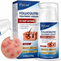 Flyleaf Folliculitis Treatment Cream with Benzoyl Peroxide & Tea Tree Oil, Fast-Acting Scalp & Body Bump Relief, 100g
