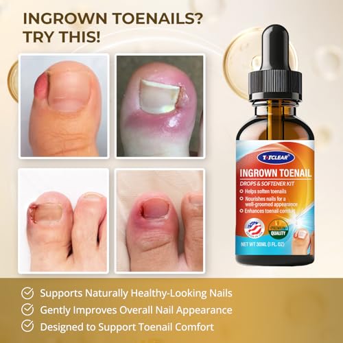 Ingrown Toenail Relief Drops & Removal Kit - 2 Pack, 1 Fl Oz Each - Toe Nail Lifter & Silicone Caps
