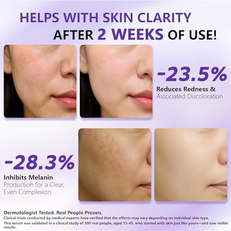 14% Tranexamic Acid Niacinamide Serum 30ML, Korean Facial Glass Skin Care Centella Serum Dark Spot Corrector Cream, Reduces Pigmentation Uneven Skin Tone, Pore Care for Sensitive Skin 1.01 FL.OZ