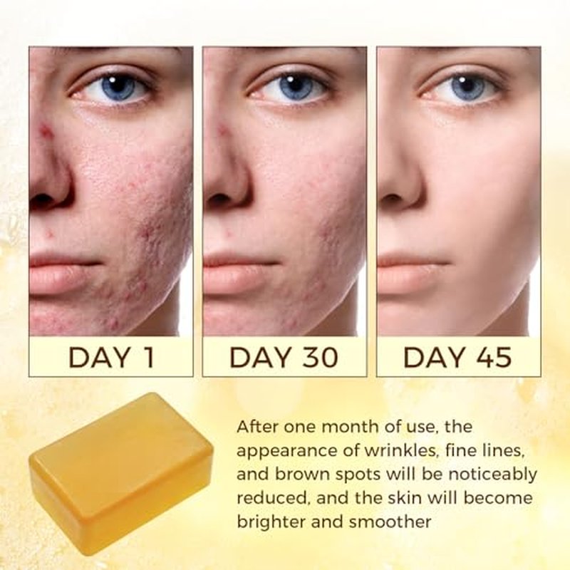Bee Venom Skin Care Cream, Propolis & Peptide Anti-Aging Moisturizer for the Appearance of Fine Lines & Wrinkles, Hydration & Firming, For All Skin Types (2.12 fl oz)