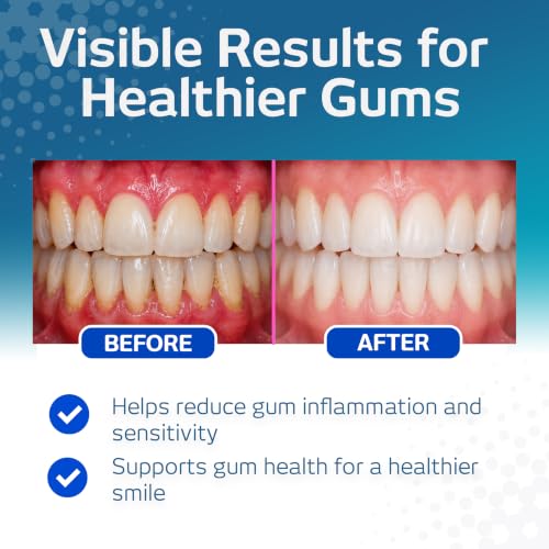 Gentle Gingival Mouthwash for Sensitive Gums - Alcohol-Free 500ml