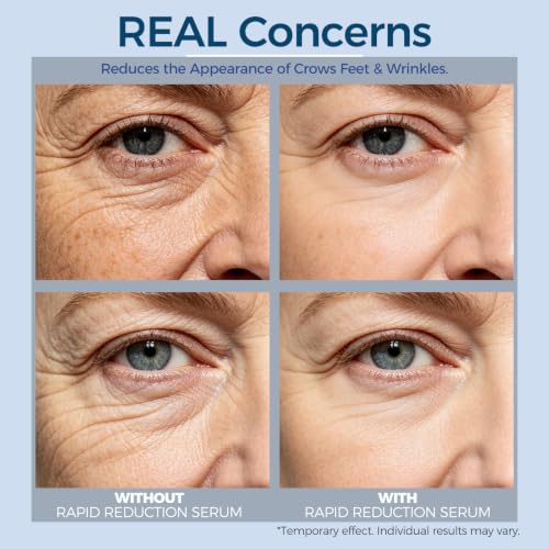 Rapid Reduction Eye Serum 0.33 Fl Oz - Reduces Under-Eye Bags Wrinkles Dark Circles Fine Lines Crow's Feet